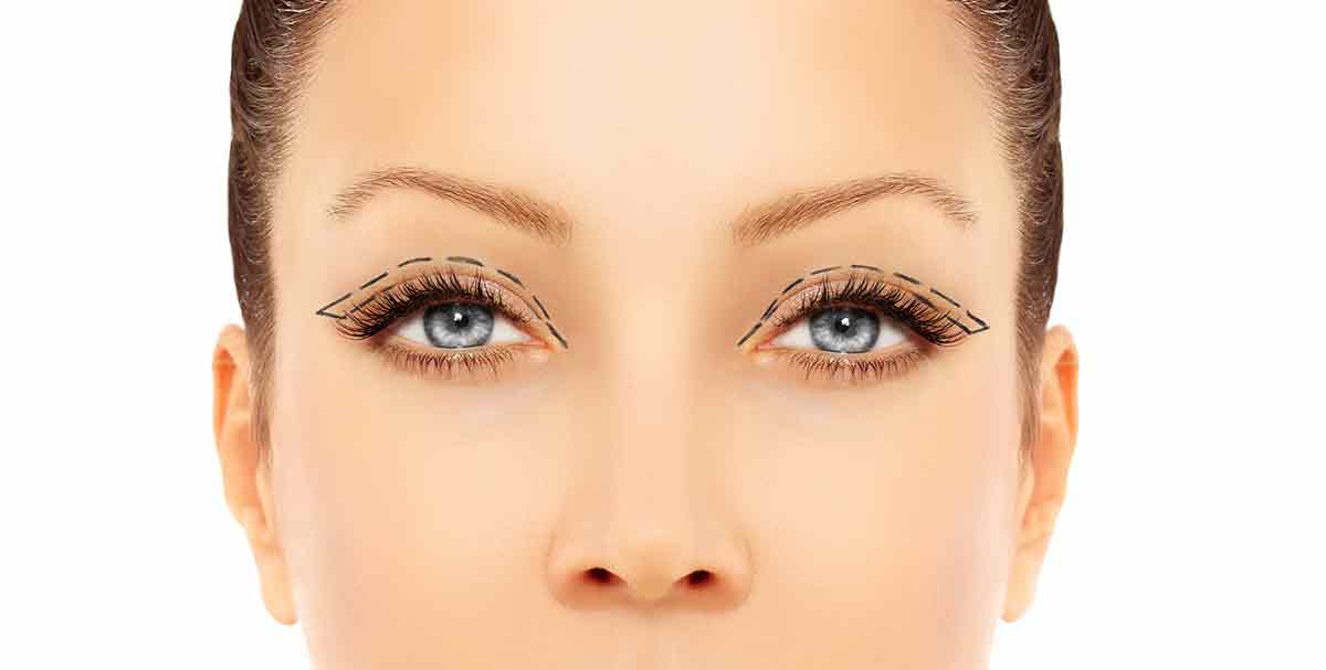 eyelid aesthetics